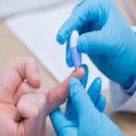 hiv finger